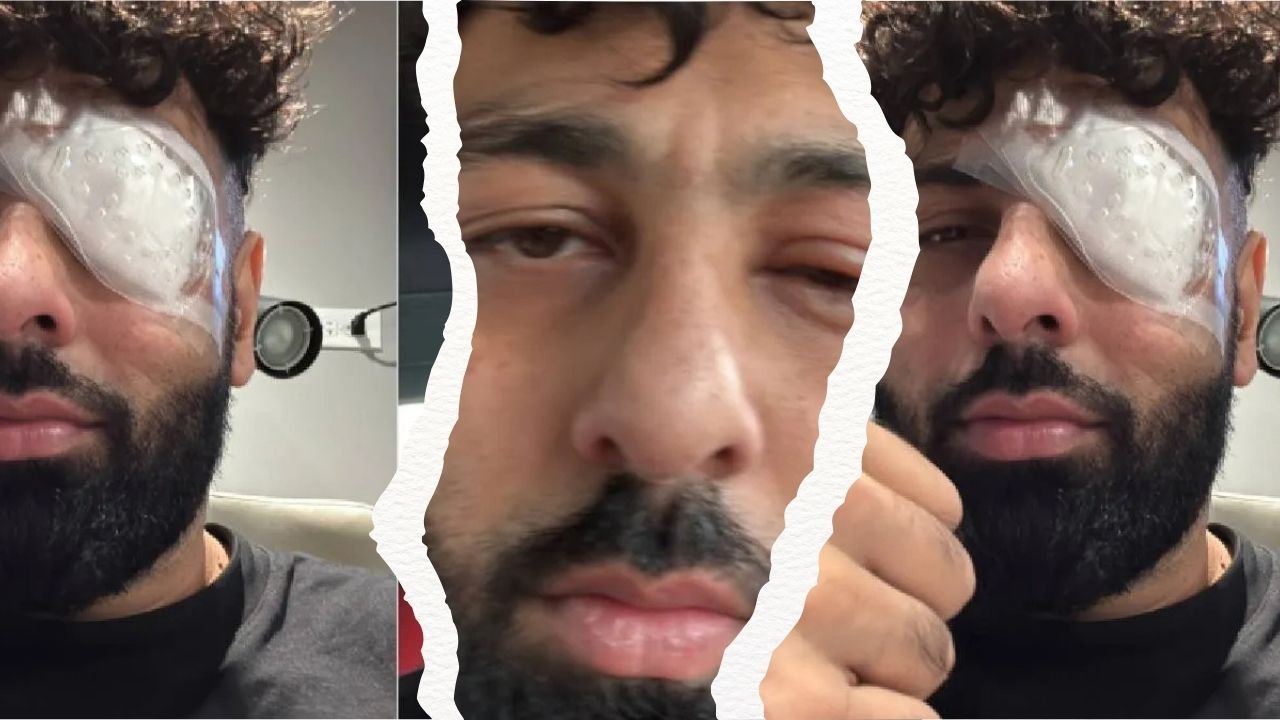 बादशाह की आंखें सूजी, चेहरा चोटिल, इंस्टाग्राम पर शेयर की तस्वीरें, मजाकिया अंदाज में बताया नेटफ्लिक्स सीरीज का असर