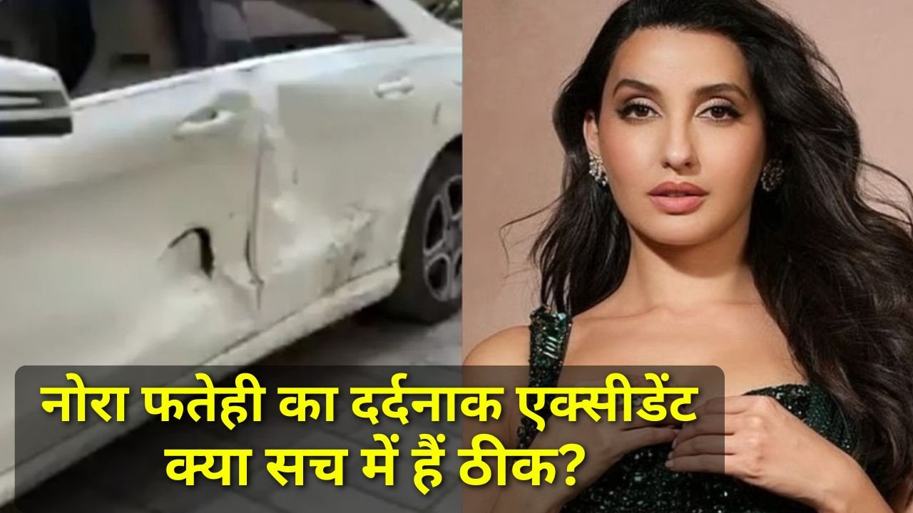 Nora Fatehi Update नोरा फतेही ने खुद बताया एक्सीडेंट के पीछे का डरावना सच, जानिए क्या था हादसे का असली कारण